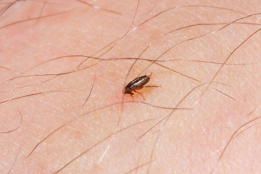 A flea on human skin.